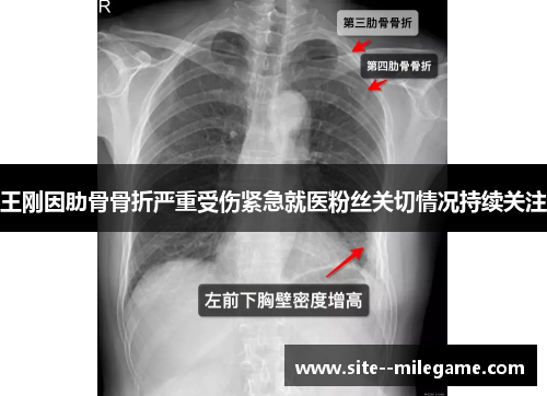 王刚因肋骨骨折严重受伤紧急就医粉丝关切情况持续关注